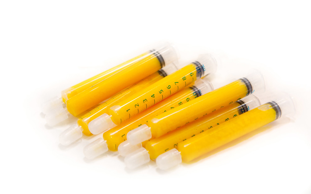 Lipofilling ou transfert de graisse
