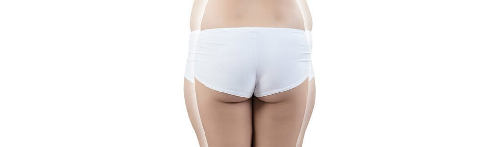 Lipoaspiration