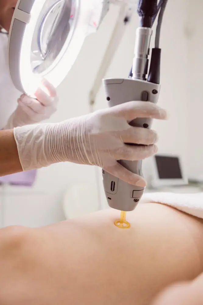 Docteur Marine HITIER - épilation définitive au laser à Annecy
