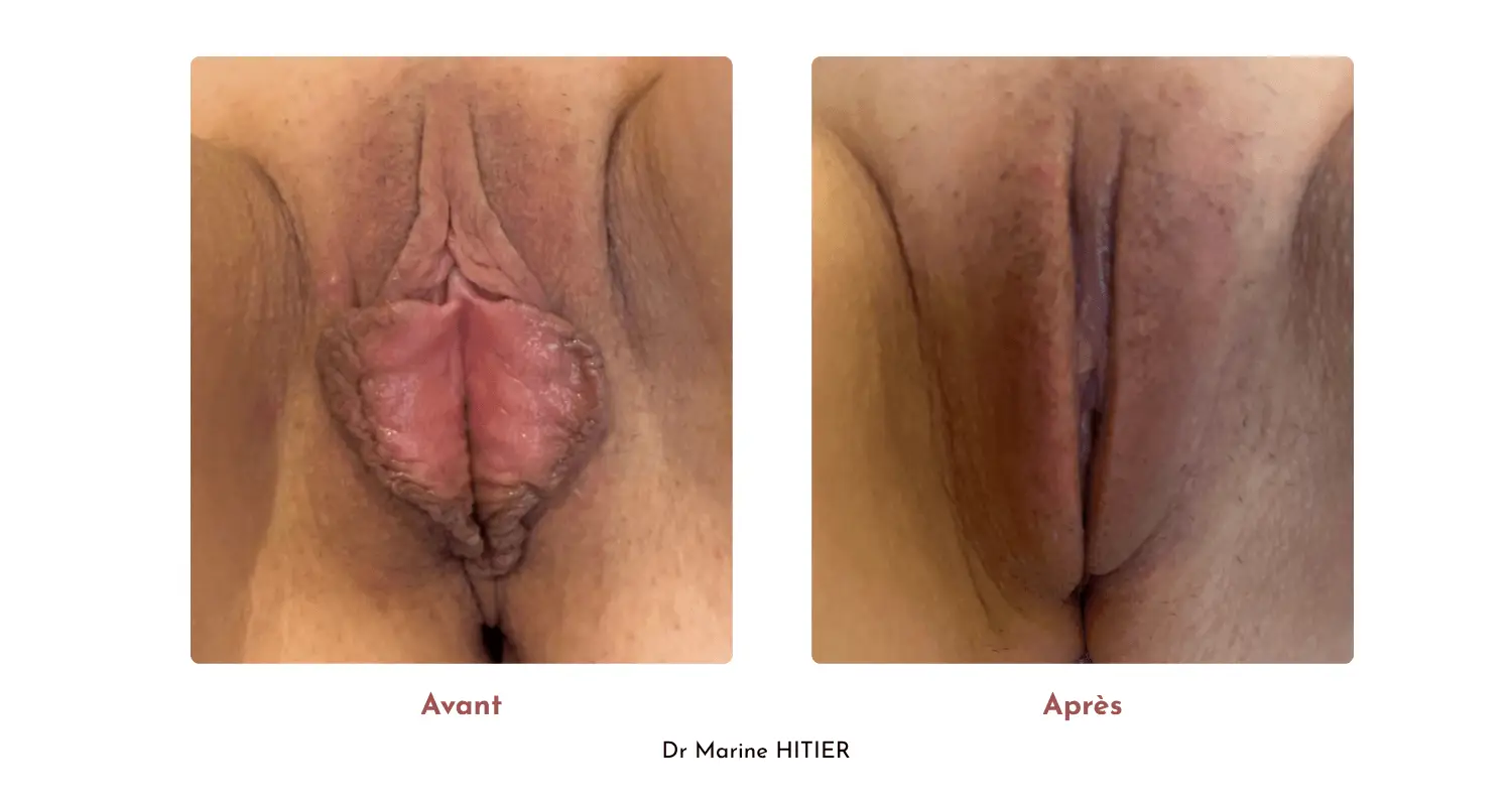 Copie de Avant (1)