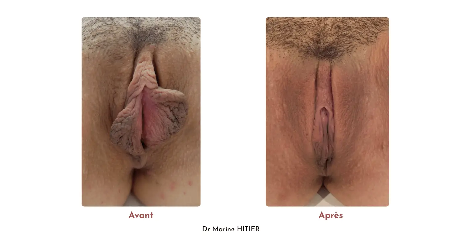 Copie de Avant (2)