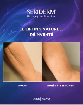 B&A 1