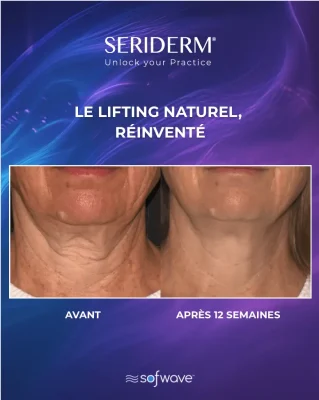 B&A 3