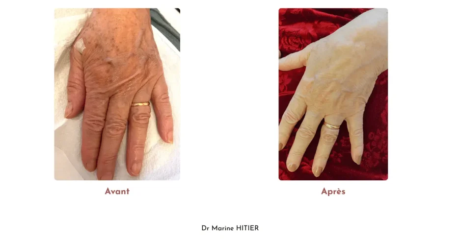 Copie de Avant (9)